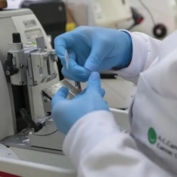 SUS INCLUI NOVA TERAPIA PARA PACIENTES ADULTOS COM LEUCEMIA MIELOIDE